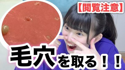 【閲覧注意】毛穴の角質を抜いたらエグいほど出てきた….