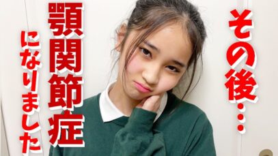 【痛い】痛くて…固いもの食べれない…顎関節症になりました…その後…